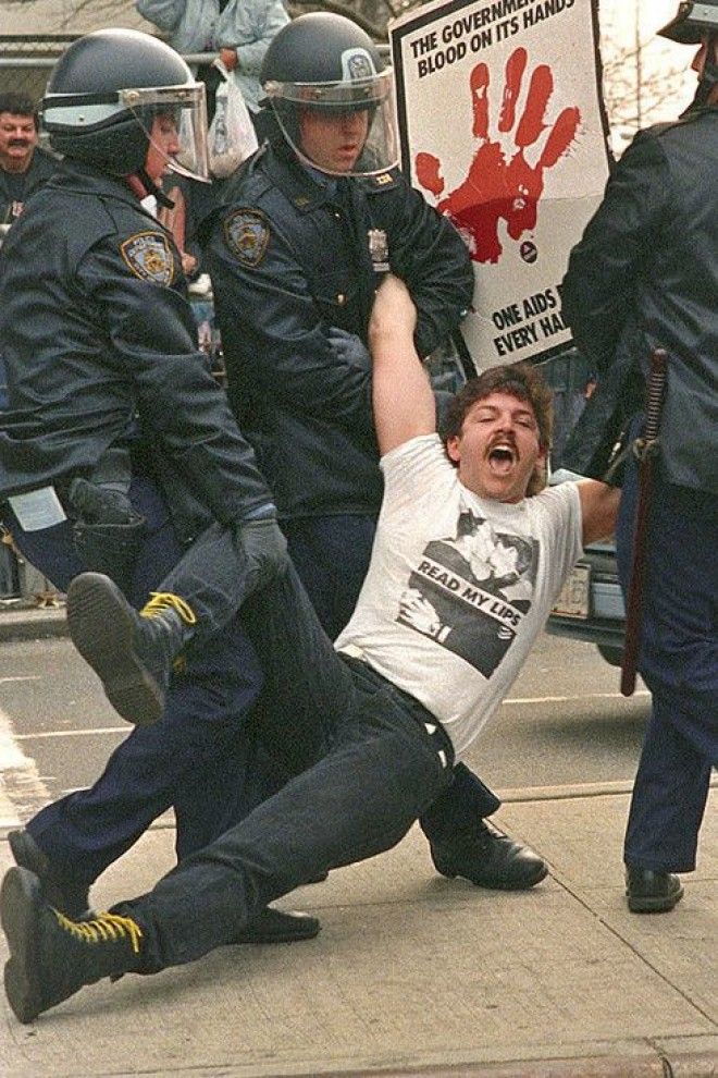 Как к людям пришел СПИД история в фотографиях