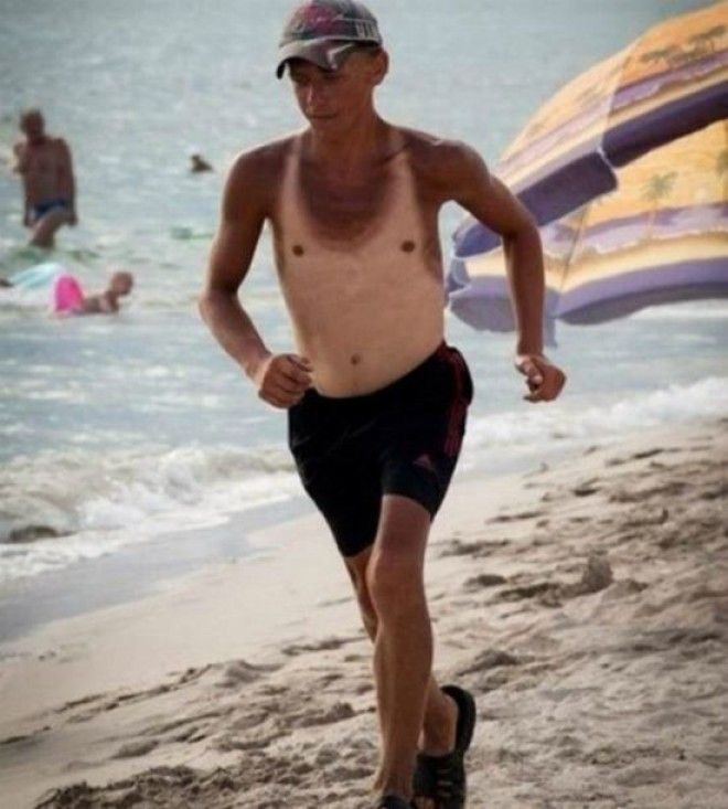 Как не стоит загорать 23 фото