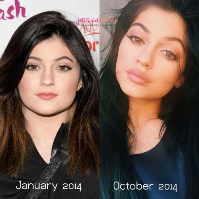 Топ8 знаменитостей которые легли под нож хирурга в слишком юном возрасте