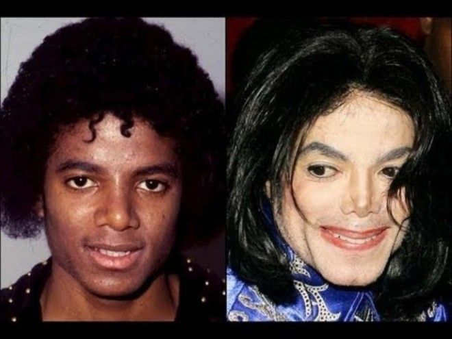 Топ8 знаменитостей которые легли под нож хирурга в слишком юном возрасте