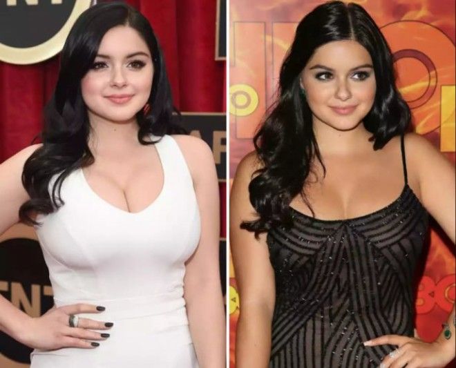 Топ8 знаменитостей которые легли под нож хирурга в слишком юном возрасте