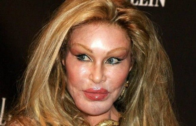 Странная зависимость хластическая хирургия