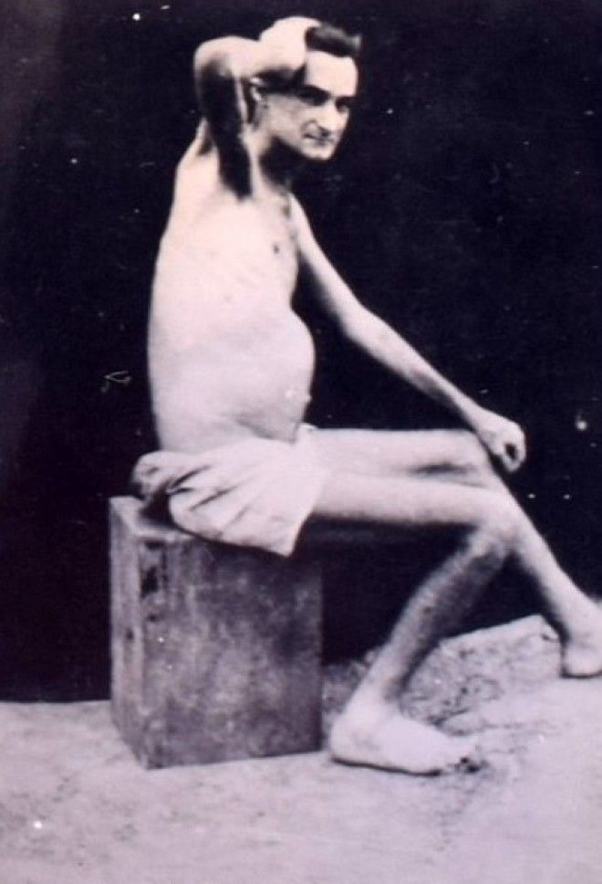 Британских пленных в Японии во время II мировой превращали в живые скелеты